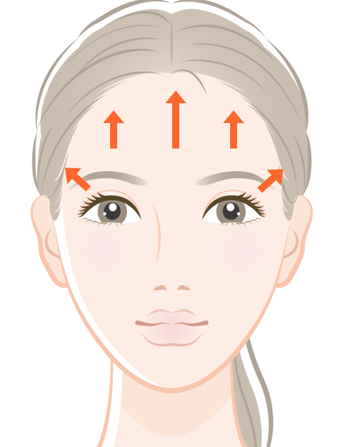 内視鏡前額リフトのイメージ