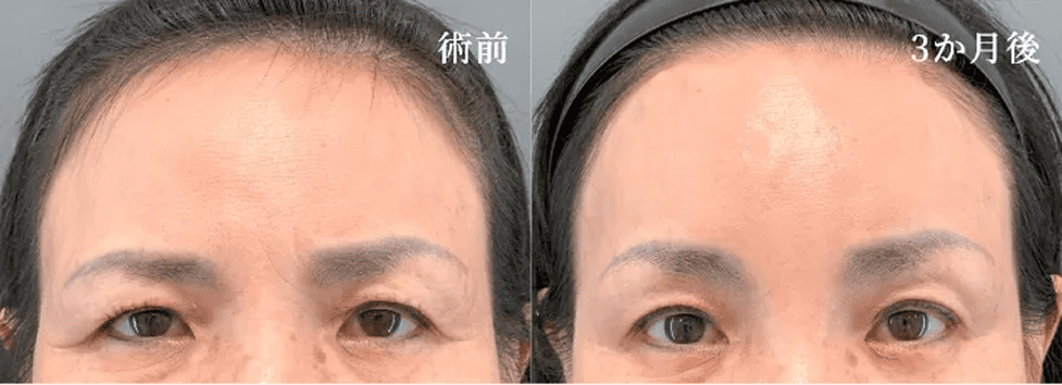 症例写真 術前・術後