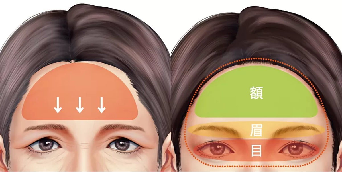 額と瞼の関係図