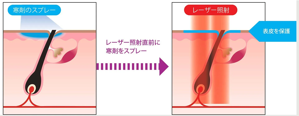 くすみ・色むらの改善