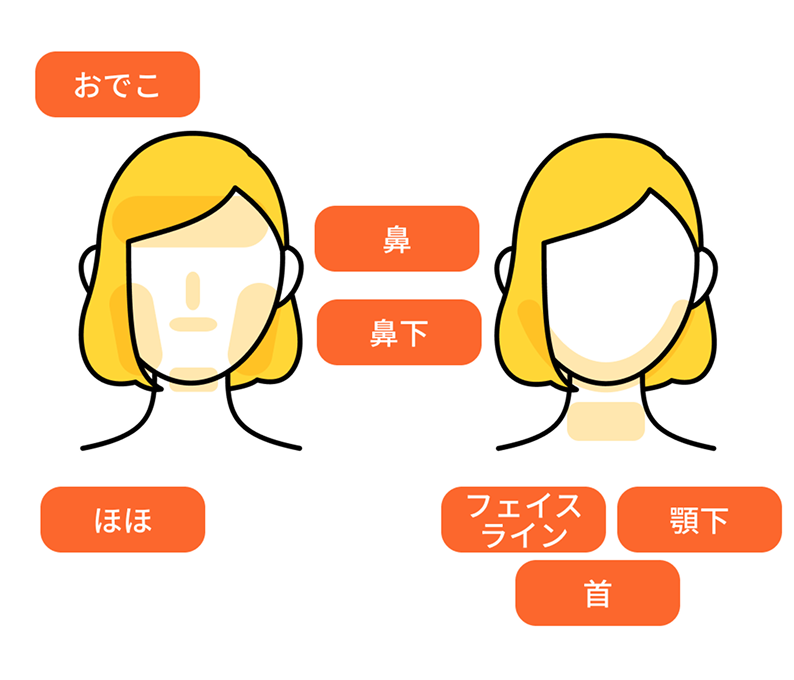 顔の脱毛部位