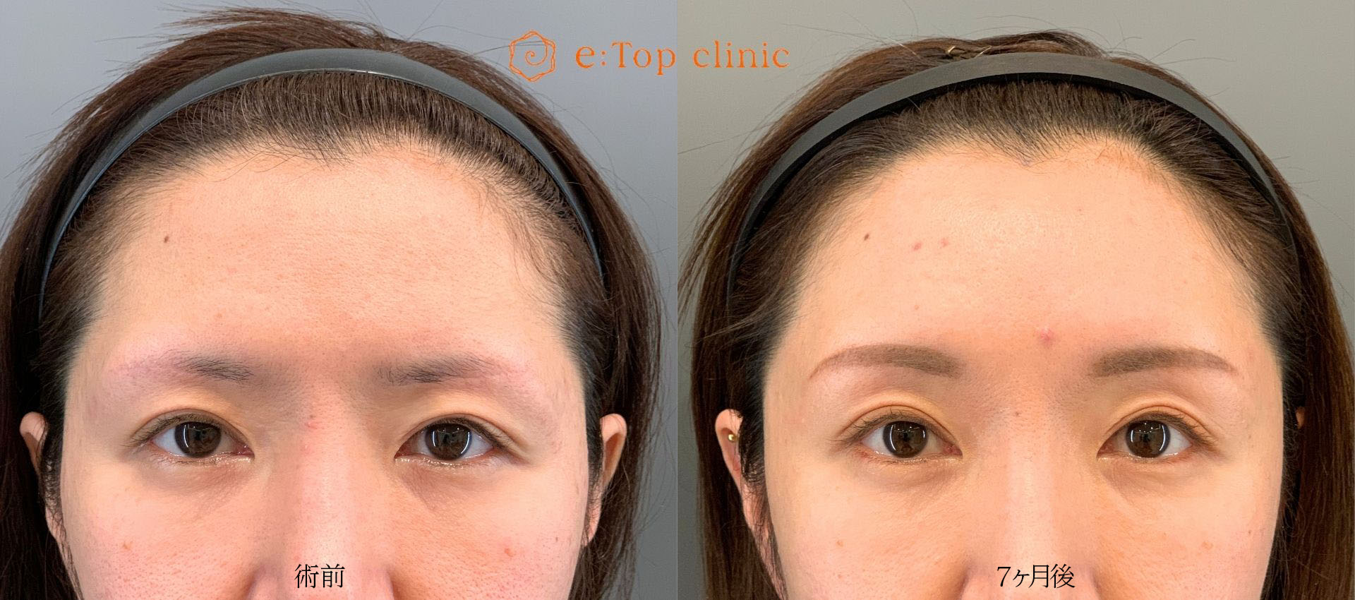 30代の症例実績 Before After